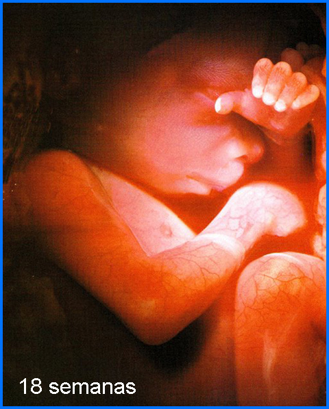 18weeks3